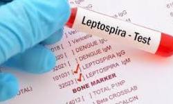 Sarajlije obolijevaju od leptospiroze zbog kašnjenja administracije